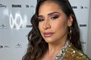 Simone "amarra" fios no nariz em novo procedimento; médico explica técnica